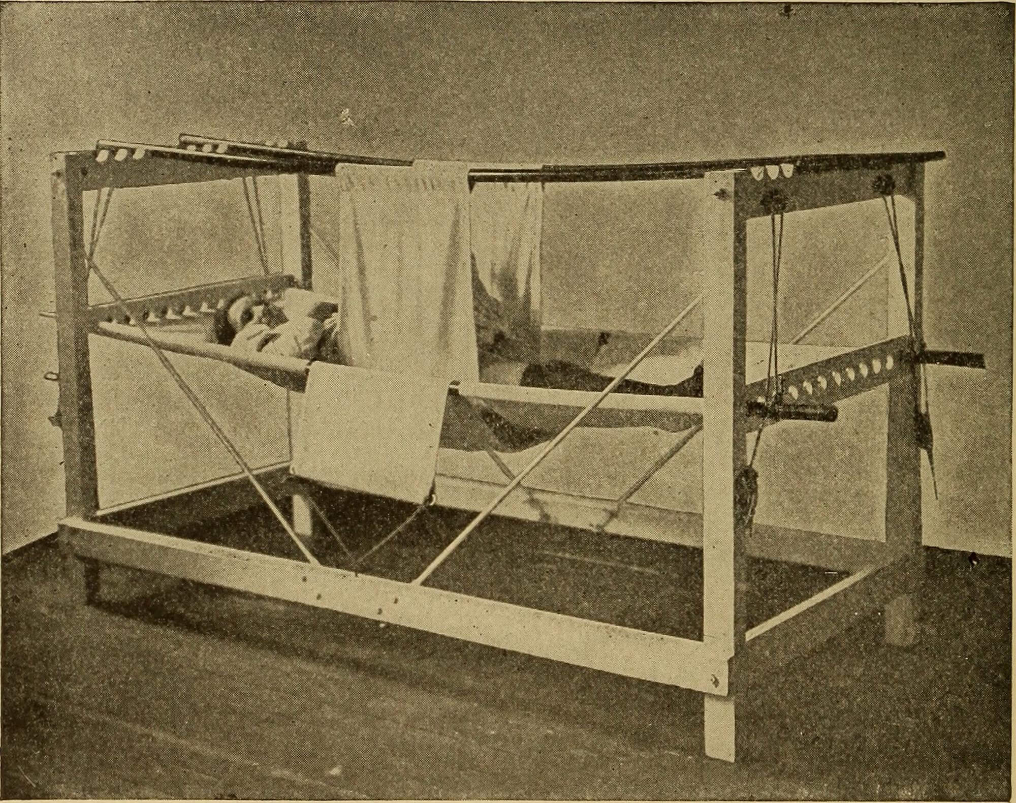 Patient in a symphysiotomy hammock after surgery, 1907