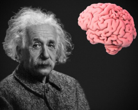Einstein brain was stolen