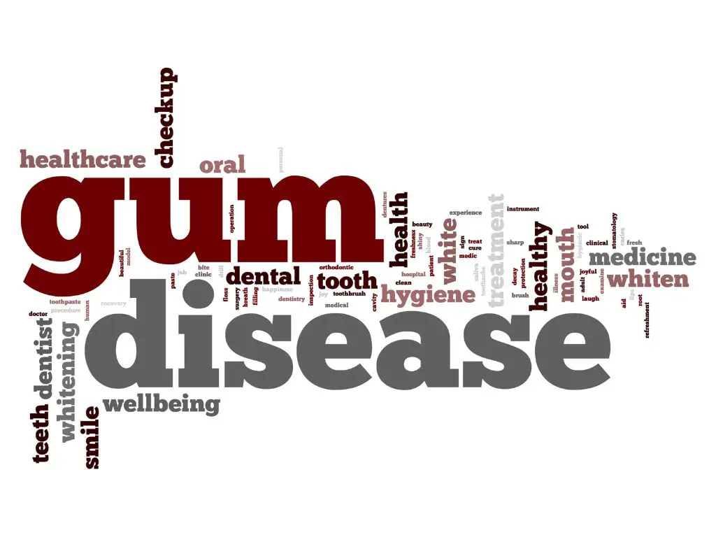 How long can you live with gum disease