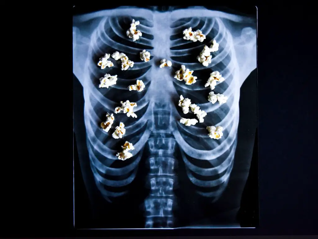 popcorn lung
