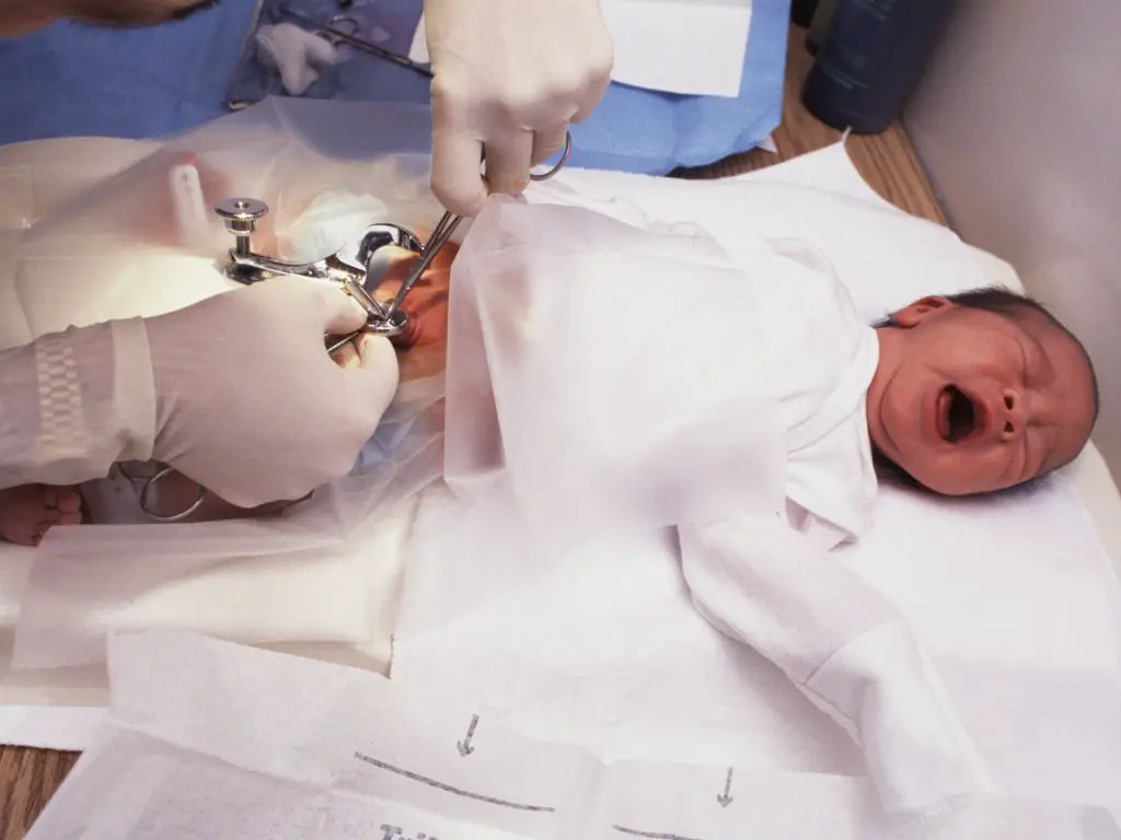 Why circumcision is good for babies