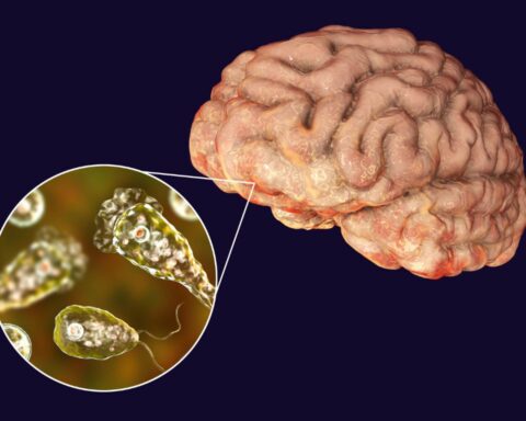 What Is Brain Eating Amoeba