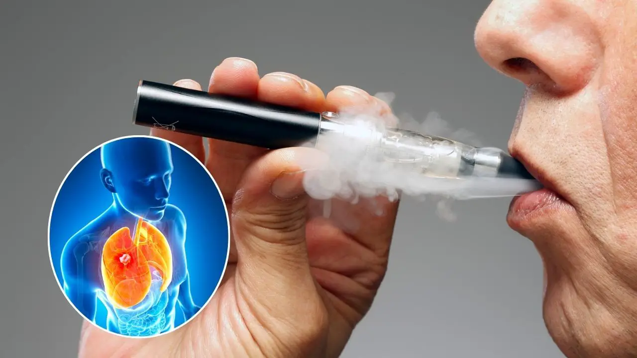 E-cigarette and lung cancer