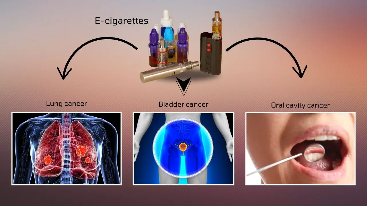 cancers associated with e-cigarettes