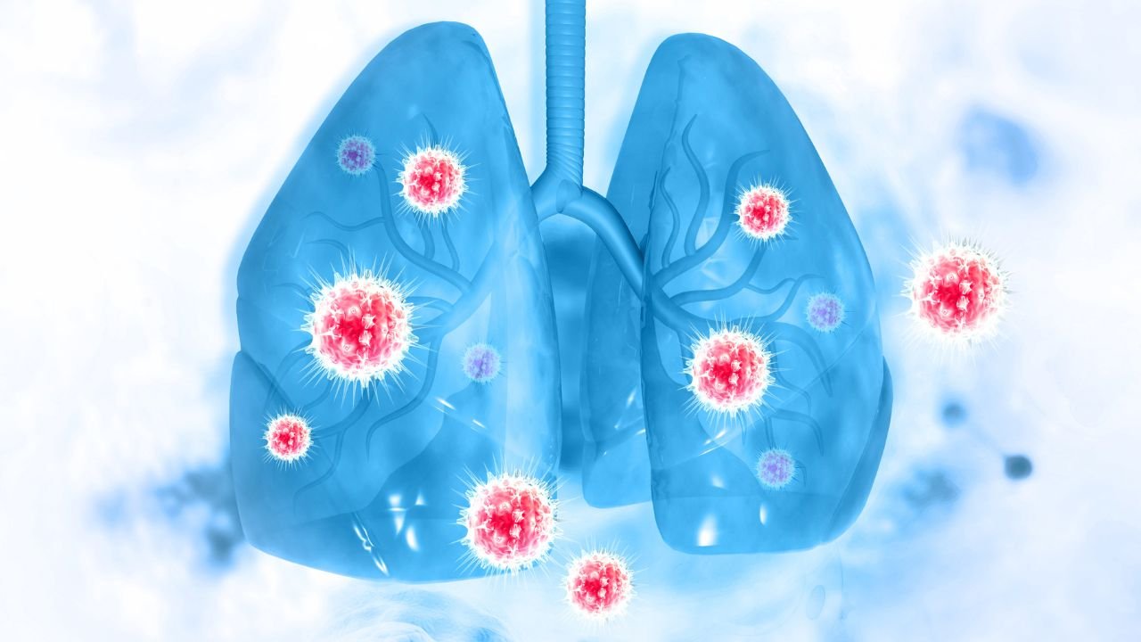 human metapneumovirus